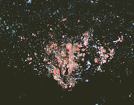 Actinomycetes8-cropped-small.jpeg