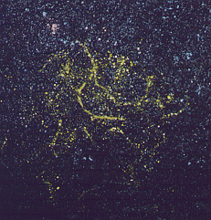Actinomycetes9-cropped-small.jpeg