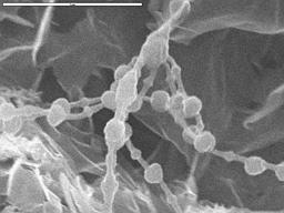 SEM image