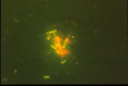AOINT234: Bacteria in biovermiculations